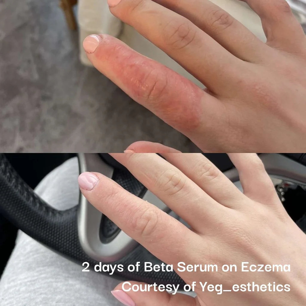 Beta Glucan Serum