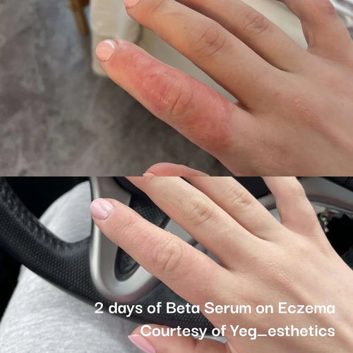Beta Glucan Serum